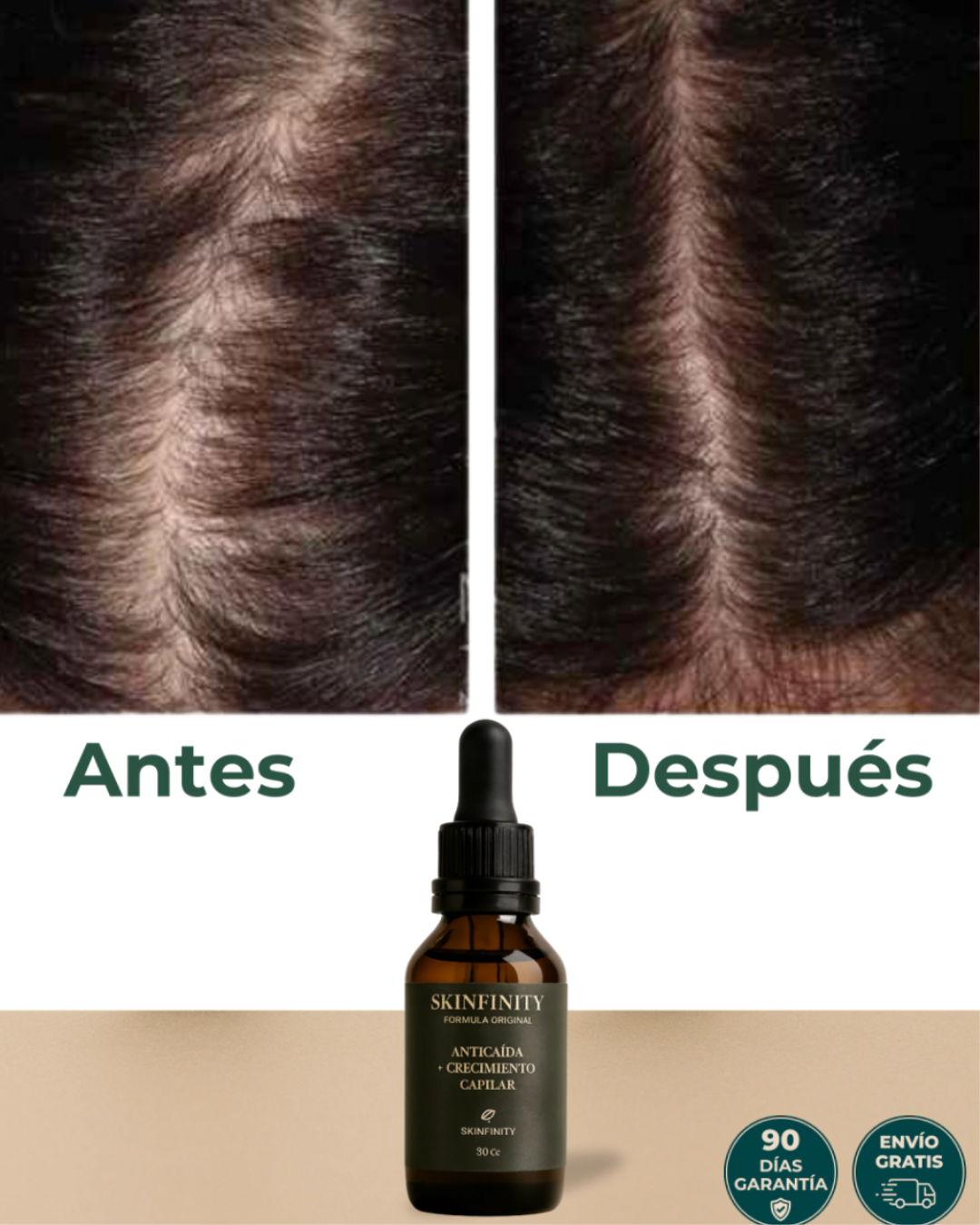 Serum anti-caida natural SKINFINITY by Nubixa